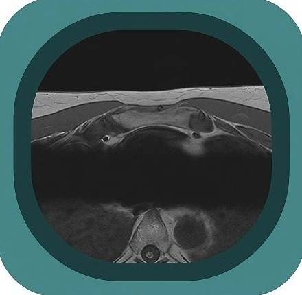 MRI sternum anatomy icon